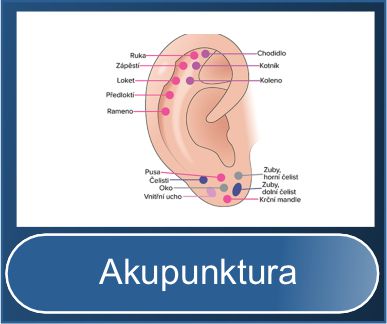 Akupunkturní jehly