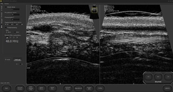 DRAMINSKI DERMAMED ultrazvuk pro dermatologii a estetickou medicínu