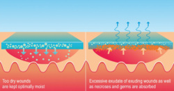 Aqua-Gel® hydrogel, sada 1.pomoci