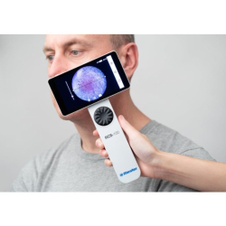 Riester RCS-100 multifunkční lékařský kamerový systém - kamera s dermatoskopickou, otoskopickou a obecnou čočkou