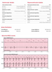 Holter EKG CORTRIUM C3 (Holter ecg)